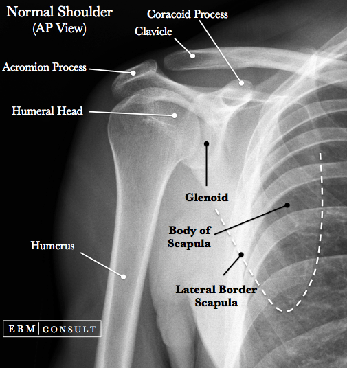 Normal Shoulder X-Ray AP View