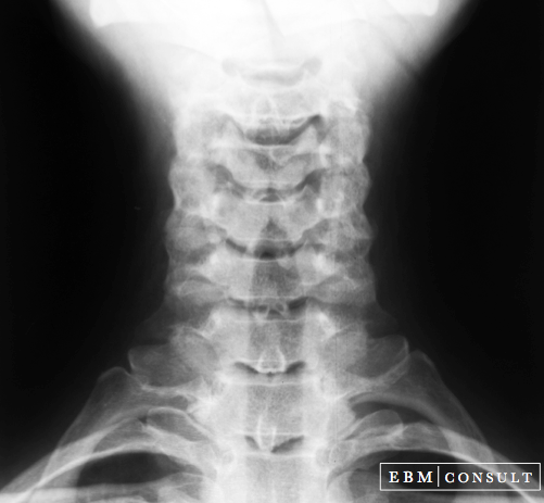 AP Neck Xray Image