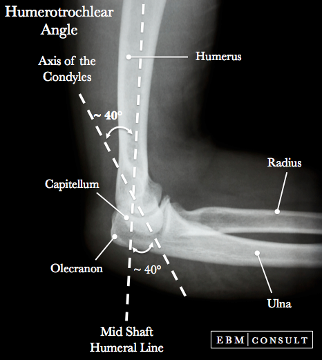 Humerotrochlear Angle Image