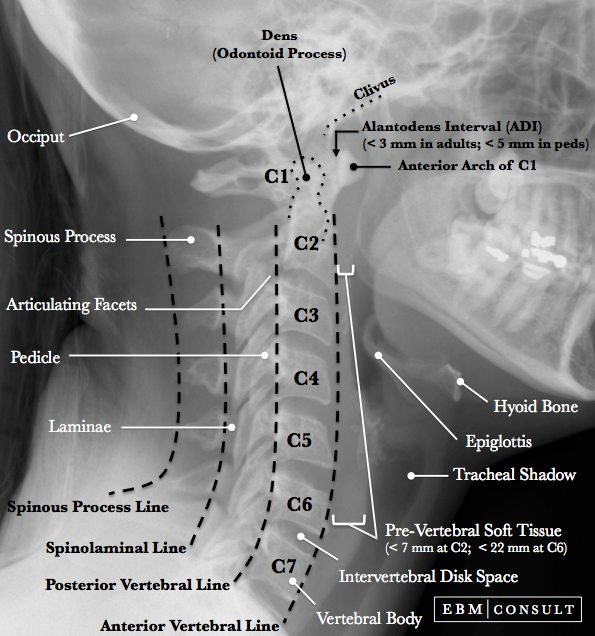 Neck X Ray Rules At Terri Whobrey Blog Neck X Ray Rules At Terri Whobrey Blog
