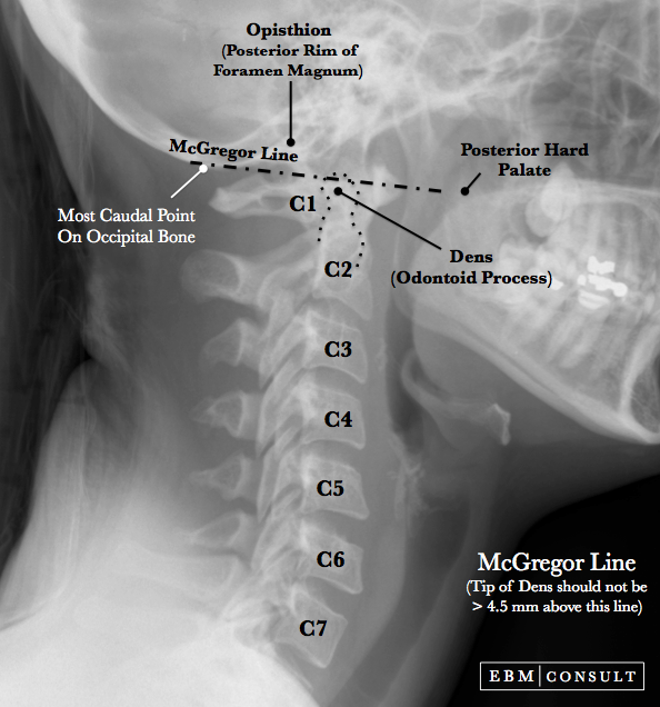 McGregor Line Image