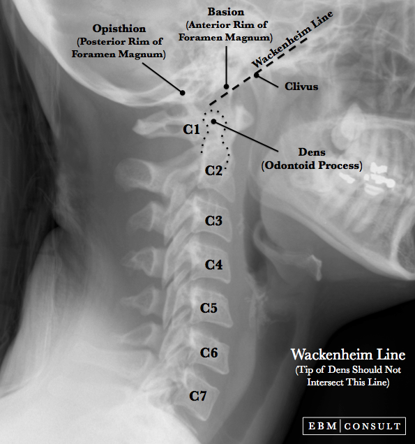 Wackenheim Line Image